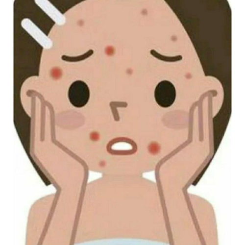 精油痘痘蘆薈凝膠 多特瑞純正精油 粉刺 青春痘 封閉式粉刺