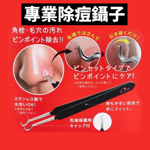 日本 專業除痘鑷子 去痘夾 擠痘神器 美容工具 臉部清潔